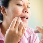 آیا آرایش باعث آکنه می شود؟