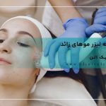هزینه لیزر موهای زائد
